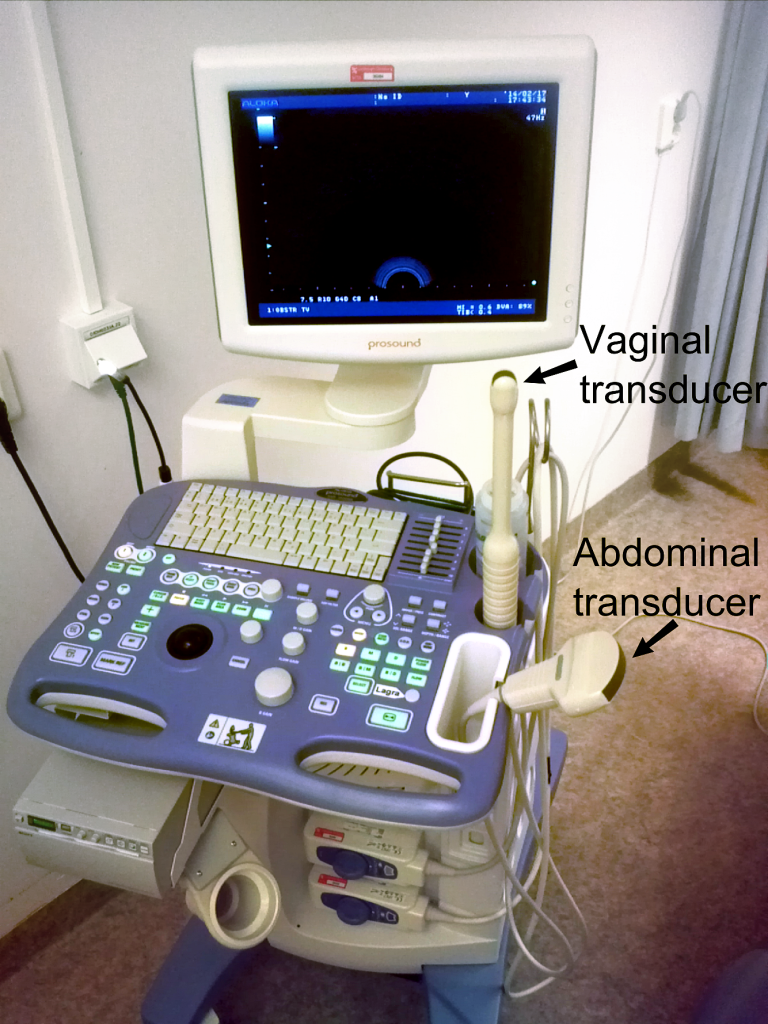 초음파검사Ultrasonography
