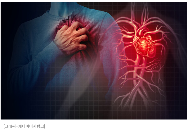 혈관조영술, 가슴부여잡고 있는 사진