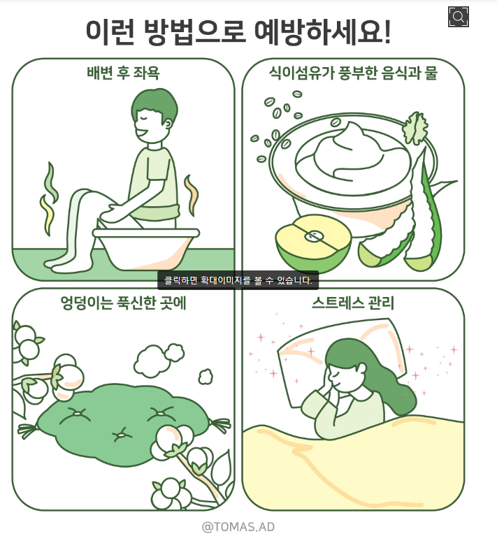 치질 예방 방법 4가지 사진
