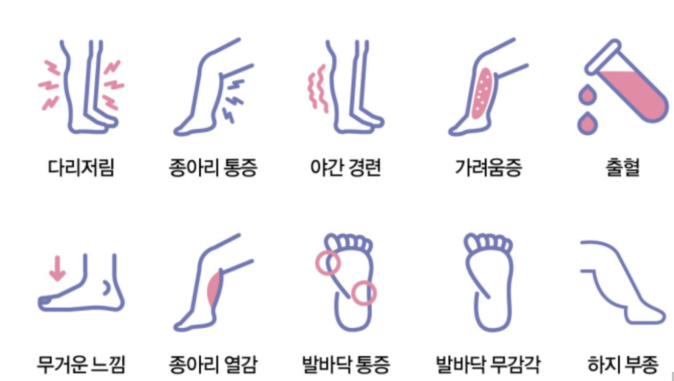 하지 정맥류 사진