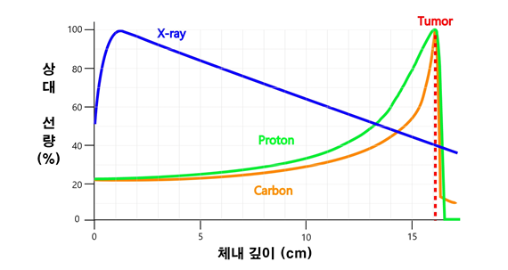중입자 치료 사진