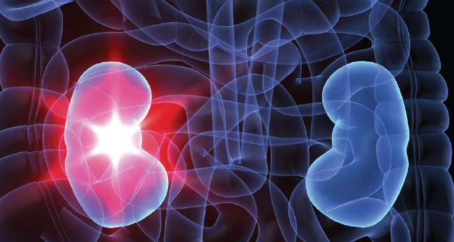 좌 우 신장과 신장염