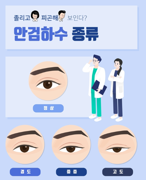 안검하수 자가진단
