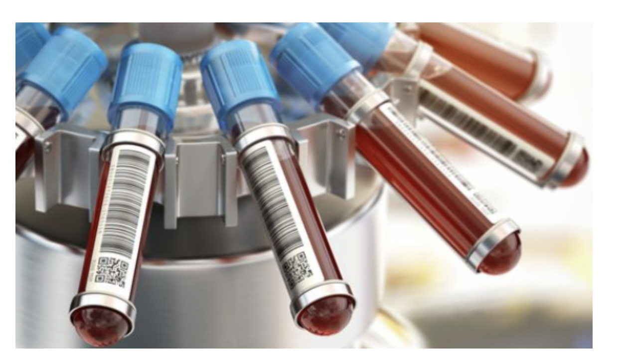 신장염 진단 및 검사